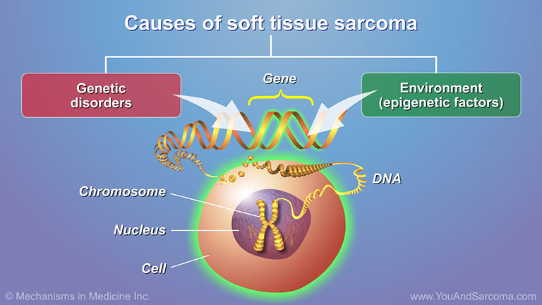 Understanding Soft Tissue Sarcoma